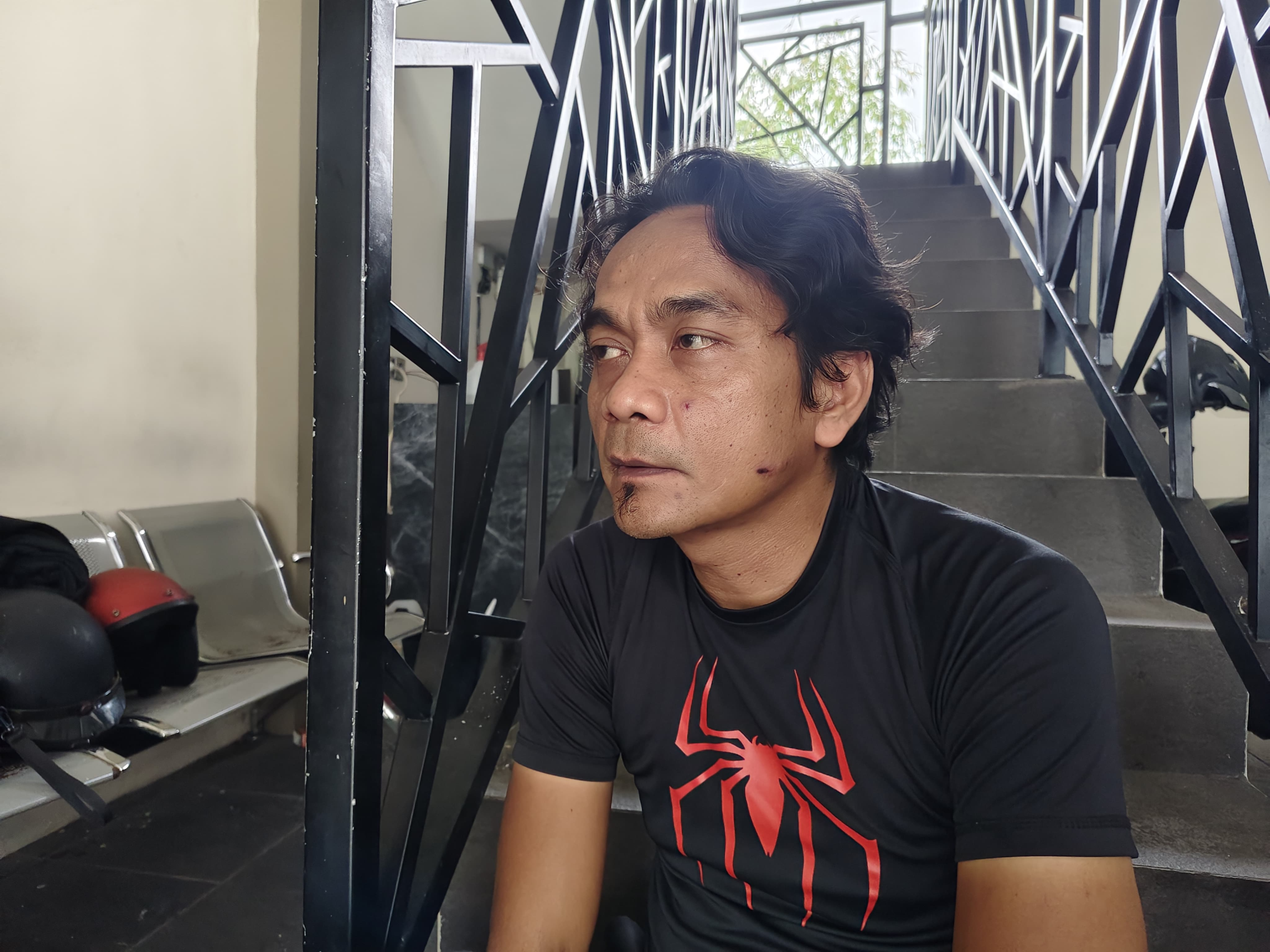 Korban Beberkan Detik – Detik Dirinya Diberondong Pluru dari Jarak Dekat, 2 Proyektil Masih Bersarang di Tubuhnya